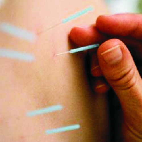 Acupuntura e Terapias Afins